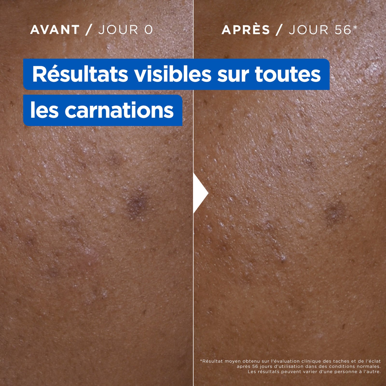 Mixa Crème Niacinamide Correction Eclat – Image 3